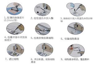 Re cell自体活性皮肤细胞移植技术,攻克大面积白癜风医学壁垒