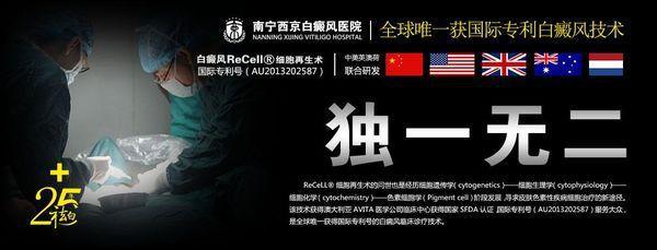 Re cell自体活性皮肤细胞移植技术,攻克大面积白癜风医学壁垒